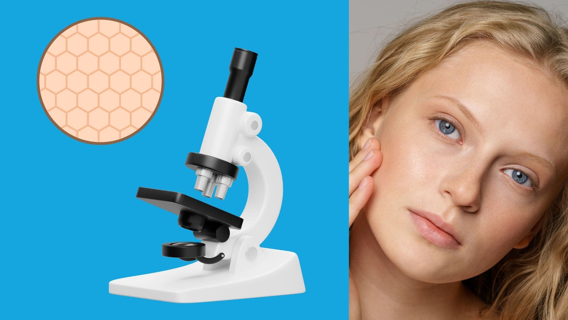 Milia – causes and symptoms